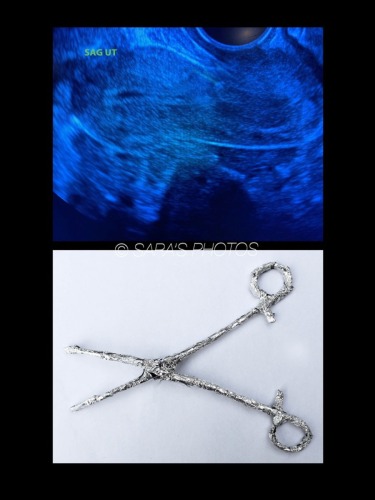 1_0017_In-Vitro-Blog
